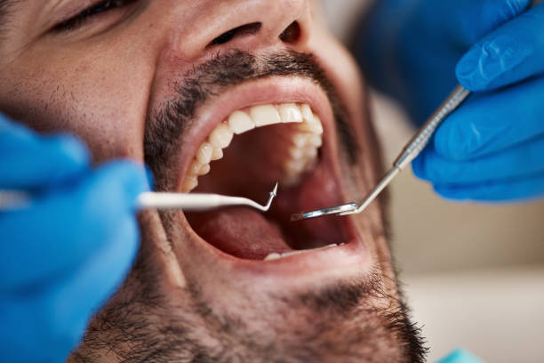 Best Emergency TMJ Treatment in Boonville, IN